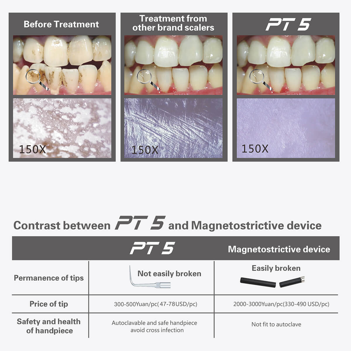 Woodpecker PT5 Painless Periodontal Treatment Device Ultrasonic Scaler Automatic Water Supply System with Titanium Tips - pairaydental.com