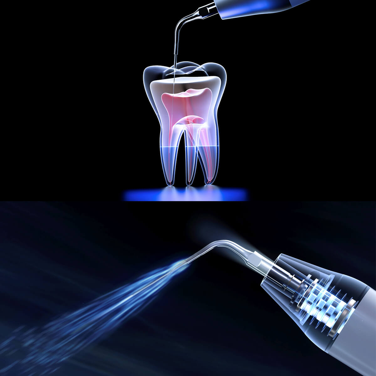 Woodpecker U600 LED Ultrasonic Scaler Smart Touch System with 700ml Auto Water Supply - pairaydental.com