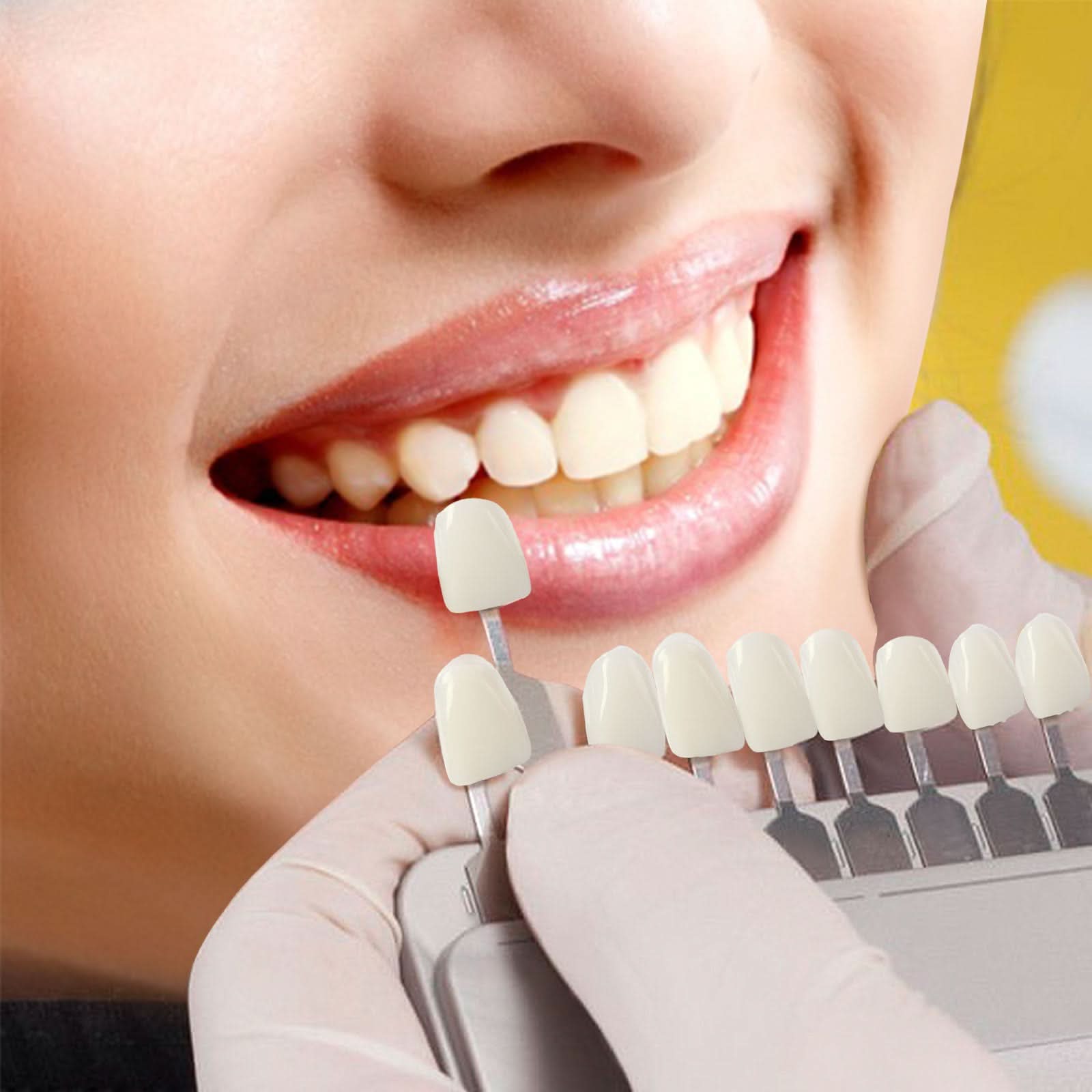 Dental Temporary Crown Kit Mixed 22#23#24# 72pcs/Box - pairaydental.com