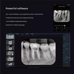 Woodpecker Dental Wireless i-Scan Imaging Plate Scanner W/Screen