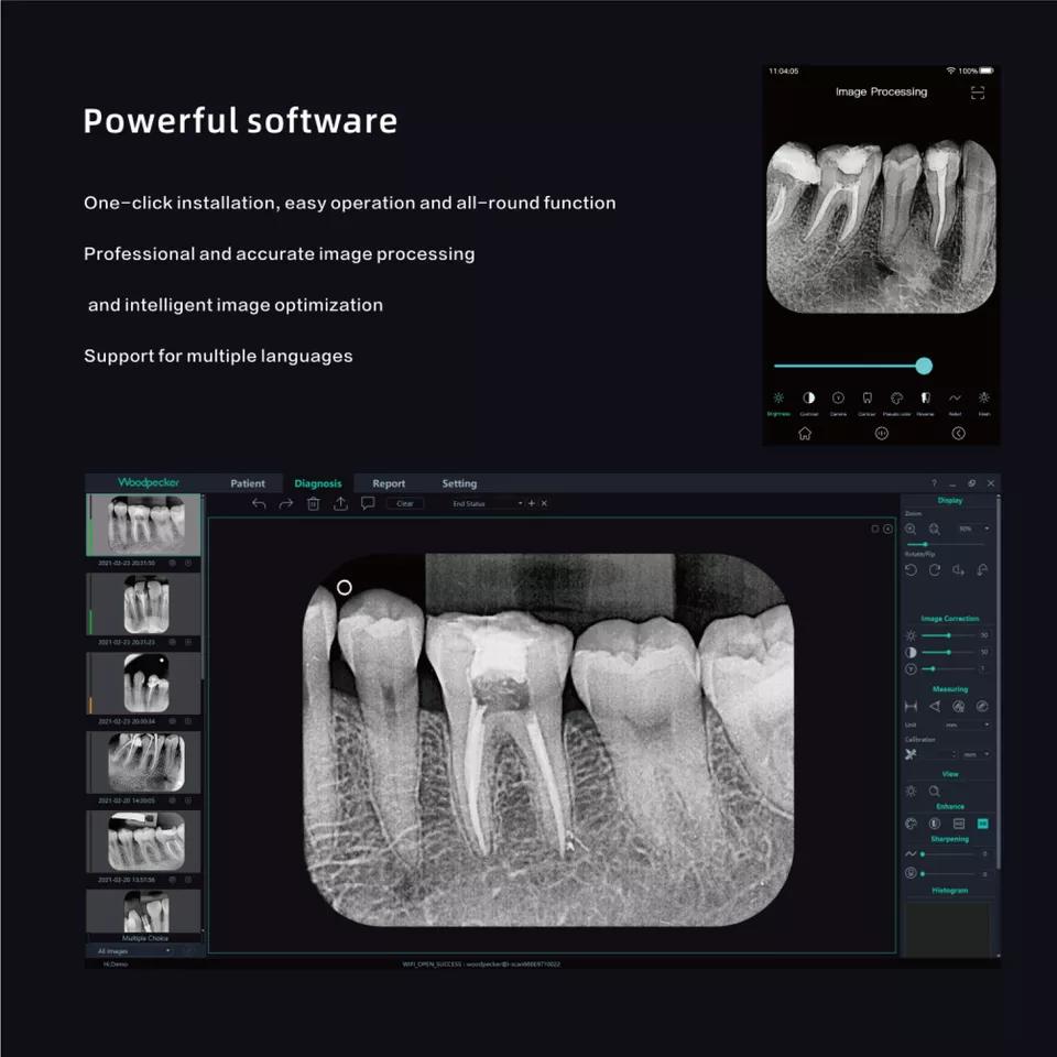 Woodpecker Dental Wireless i-Scan Imaging Plate Scanner W/Screen