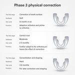 Orthodontic Appliance Adult Invisible Braces Alignment Trainer Retainers 3 Stages - pairaydental.com
