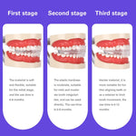 Orthodontic Appliance Adult Invisible Braces Alignment Trainer Retainers 3 Stages - pairaydental.com