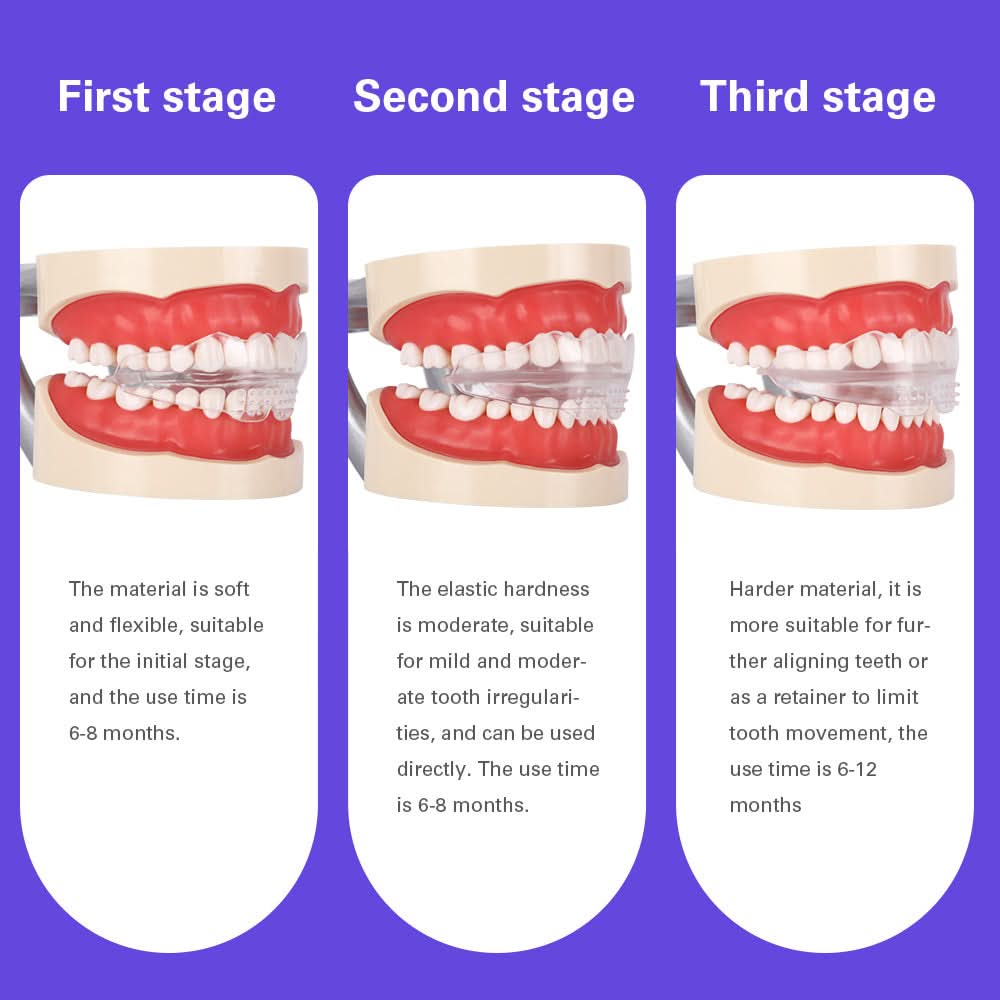 Orthodontic Appliance Adult Invisible Braces Alignment Trainer Retainers 3 Stages - pairaydental.com