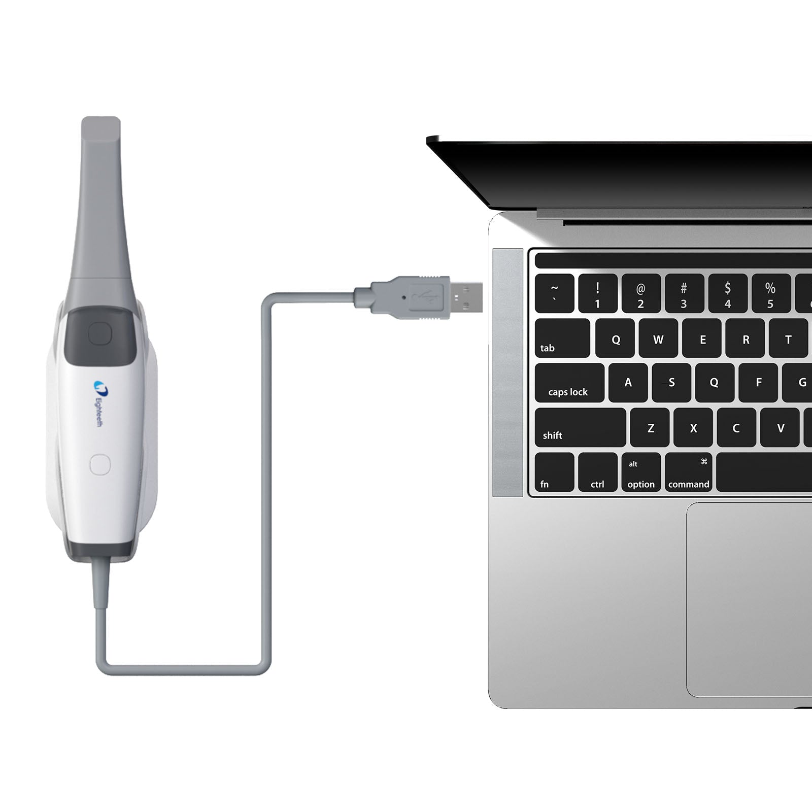 Eighteeth Dental Intraoral Scanner Helios 500 - https://pairaydental.com/