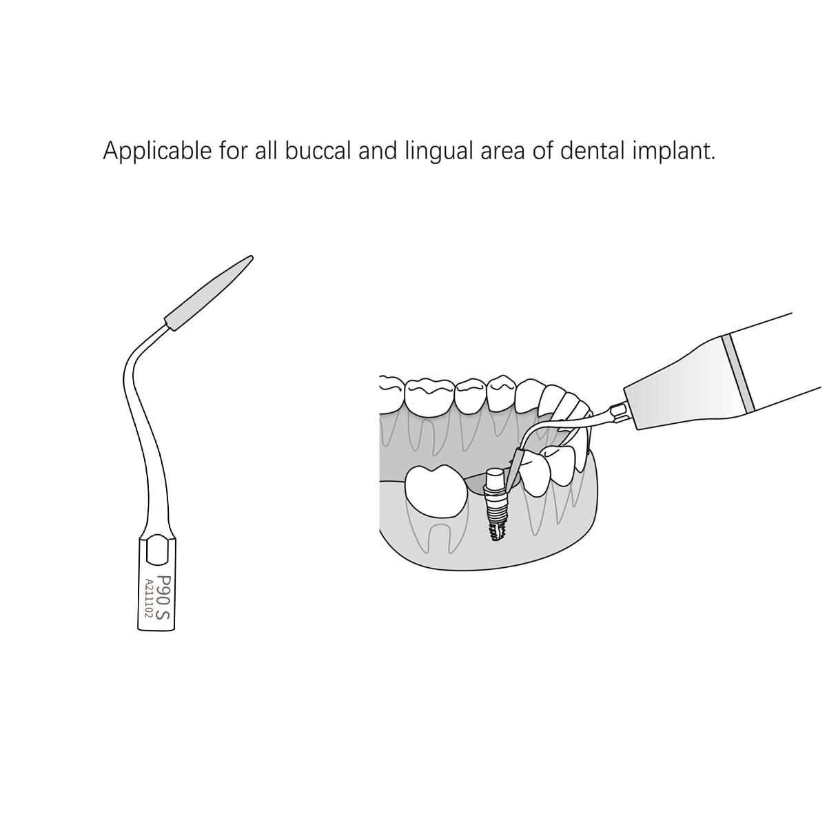 PD90 Ultrasonic Scaler Tips Periodontal Implant Cleaning Tip - pairaydental.com