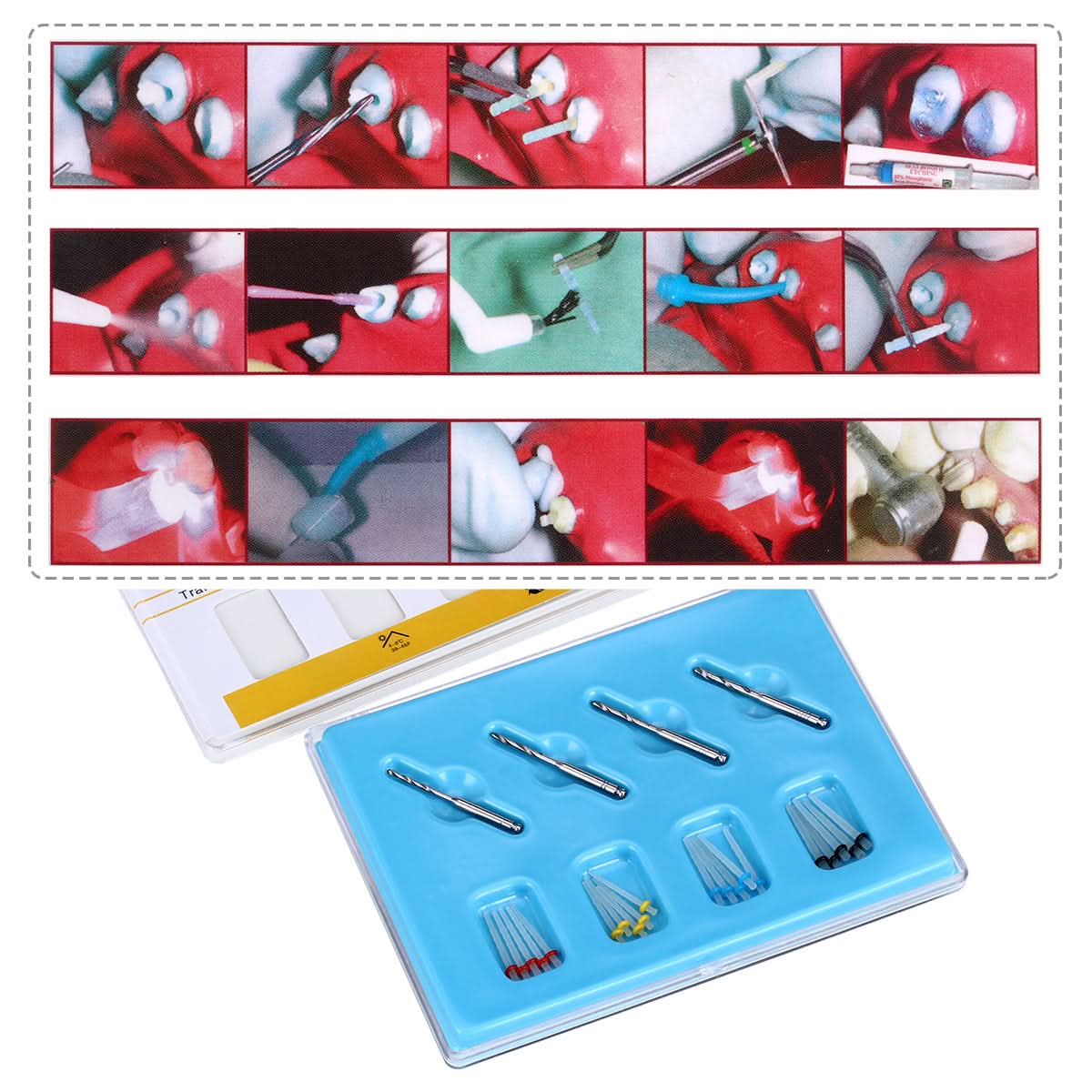 Dental Quartz Fiber Post Teeth Restore 4 Drills& 20 Fiber Posts - pairaydental.com