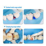 Dental Sectional Contoured Metal Matrices Matrix Refill Kit 30pcs/Box - pairaydental.com