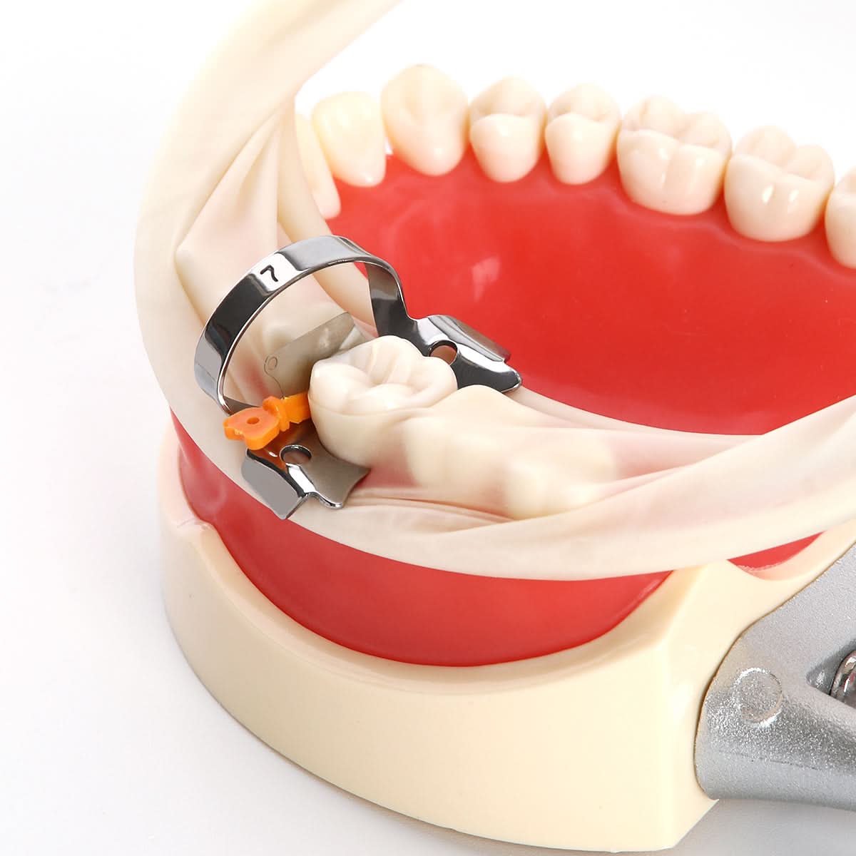 Dental Plastic Wedge Guard Prime Teeth Interproximal Metal Matrix Smal