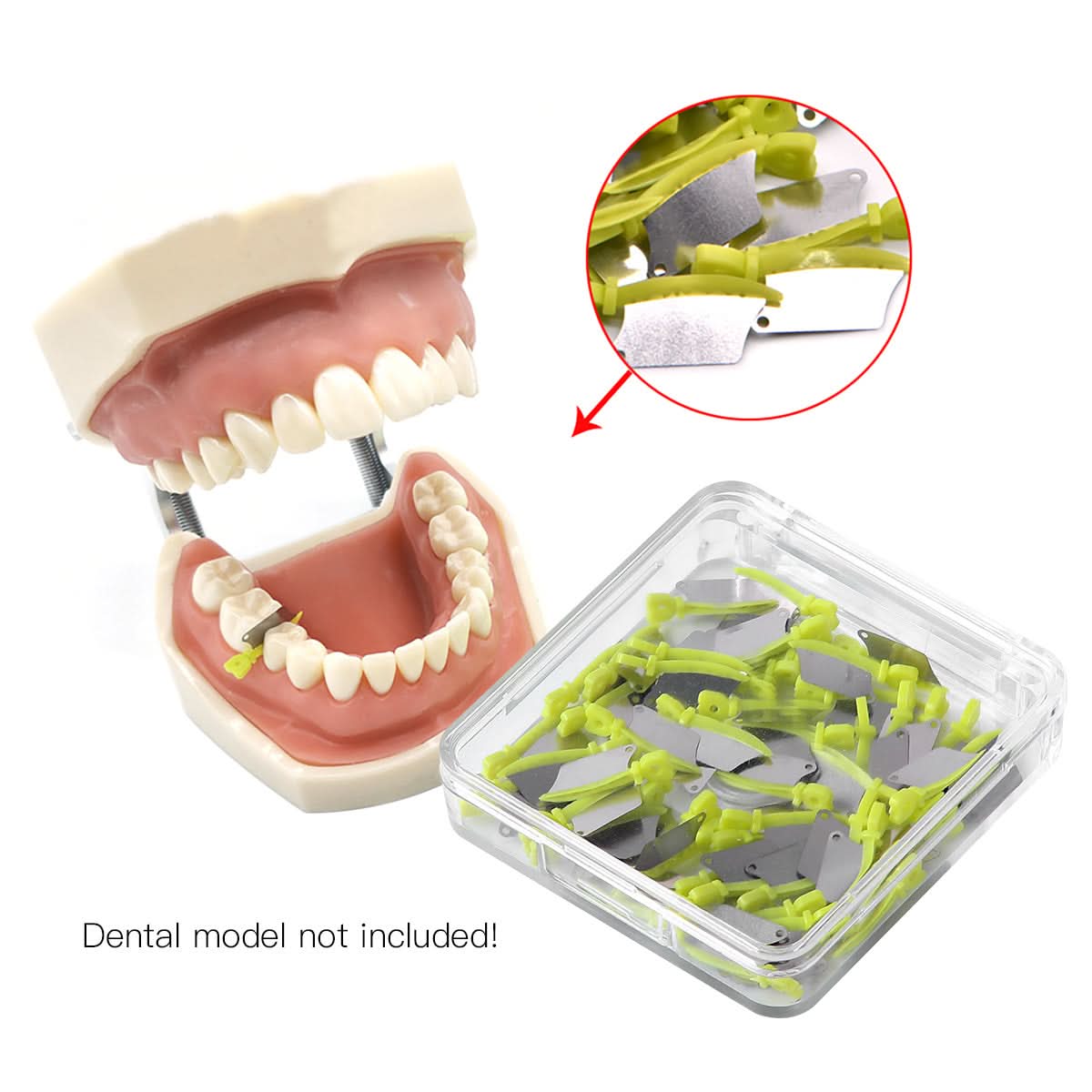 Dental Plastic Wedge Guard Prime Teeth Interproximal Metal Matrix Smal