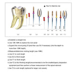Endo NiTi Rotary Files Heat Activated 25mm Assorted SX-F3 6pcs/Pk - pairaydental.com