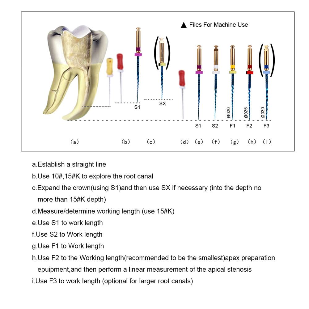 Endo NiTi Rotary Files Heat Activated 25mm Assorted SX-F3 6pcs/Pk - pairaydental.com