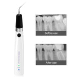 Dental Endo Ultra Activator Irrigator Cordless Root Canal Handpiece 6 Tips - pairaydentall.com