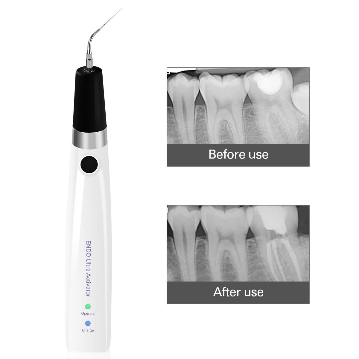 Dental Endo Ultra Activator Irrigator Cordless Root Canal Handpiece 6 Tips - pairaydentall.com