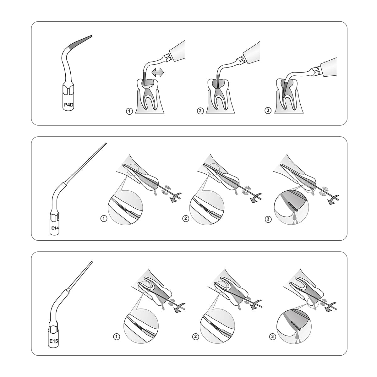 P4D Ultrasonic Scaler Perio Scaling Tips - pairaydental.com