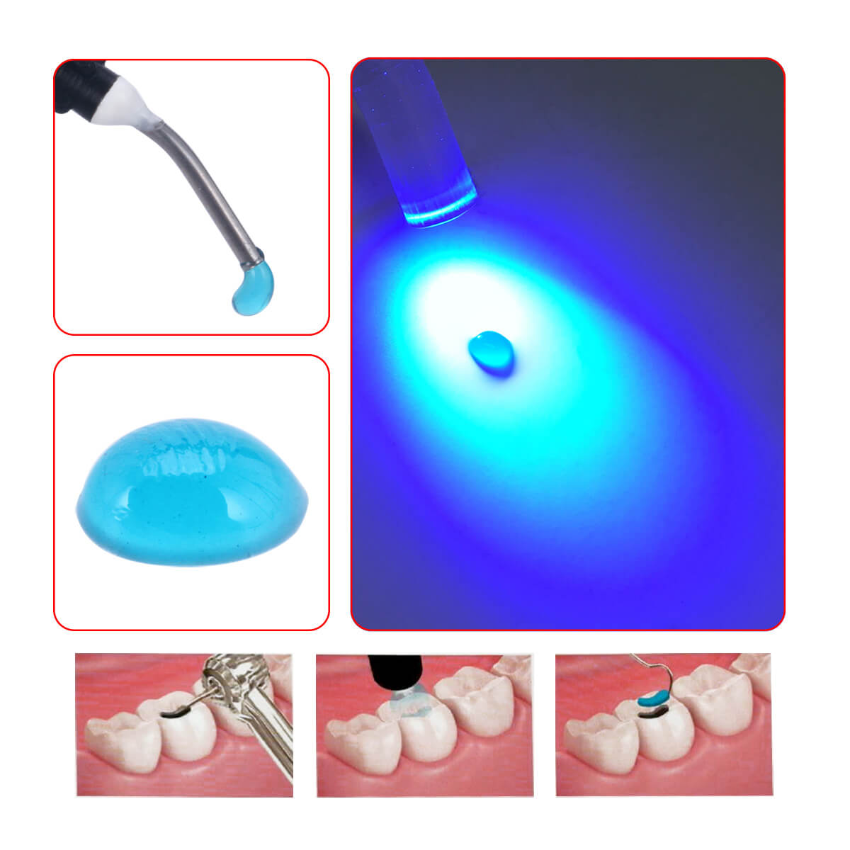 Dentex Dental Temporary Flow light Cure filling Composite Material Resin Blue 2.5g/Pack - pairaydental.com