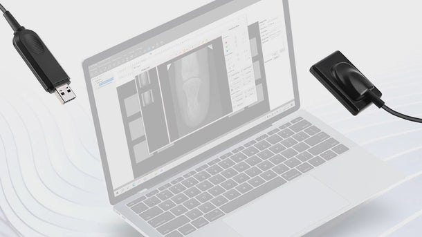 Dental Intraoral X-Ray Sensor Digital HD Image System Size 2 - pairaydental.com