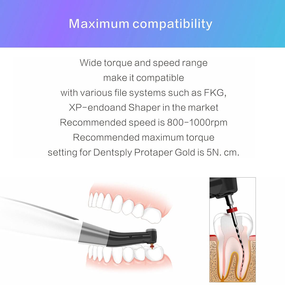 Woodpecker EndoMatic Cordless Endo Motor Built-in Apex Locator - pairaydental.com