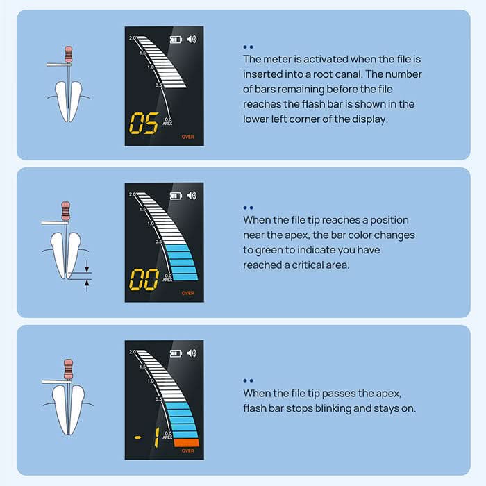 Dental Endodontic Endo Apex Locator Root Canal - pairaydental.com