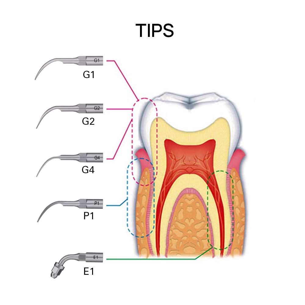 VRN Ultrasonic Scaler Wireless Control LED Handpiece and 5 Tips - pairaydental.com