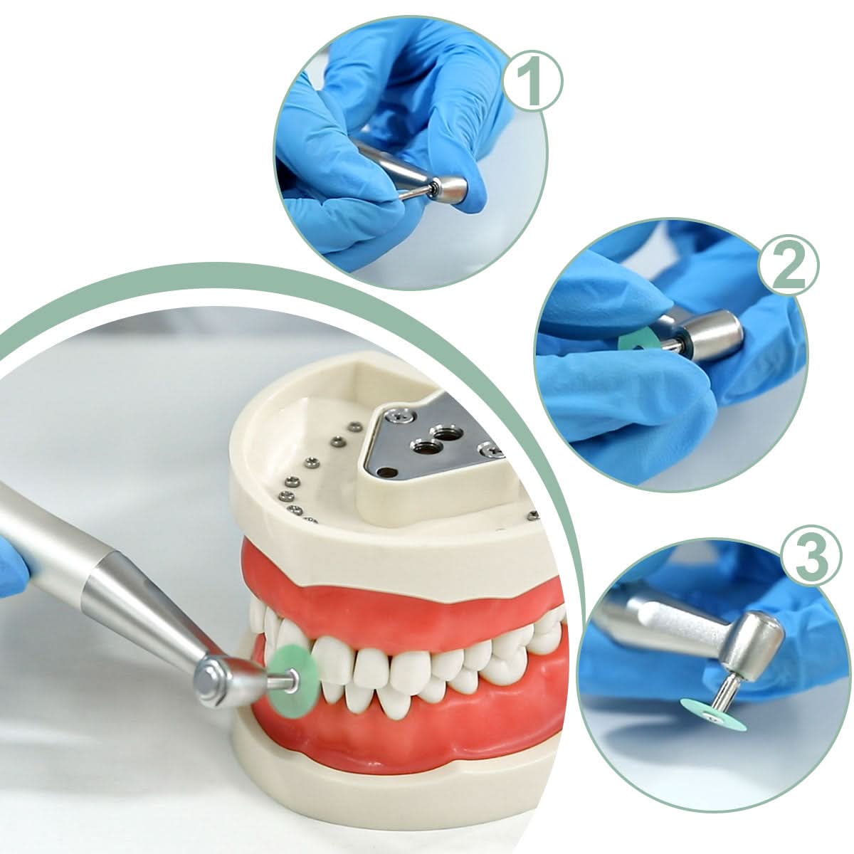 Dental Polishing Discs NO1.075 Gross Reduction Contouring Mandrel Stripes Set 80/Box - pairaydental.com