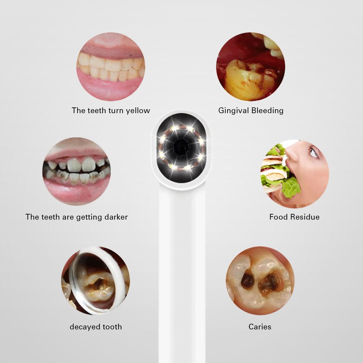 Dental Oral Endoscope USB Intraoral Camera 2 Interfaces 8 LED 3 Speed Adjustment - pairaydental.com