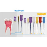 Endo Hand NiTi Super Files Heat Activated 25mm SX-F3 6Pcs/Pk - pairaydental.com