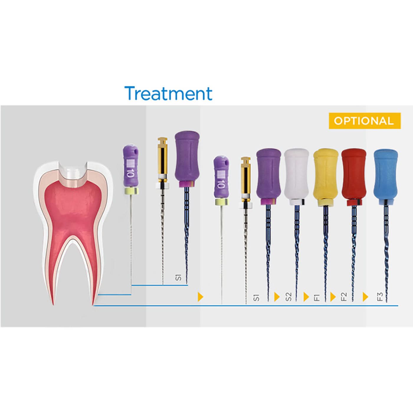 Endo Hand NiTi Super Files Heat Activated 25mm SX-F3 6Pcs/Pk - pairaydental.com