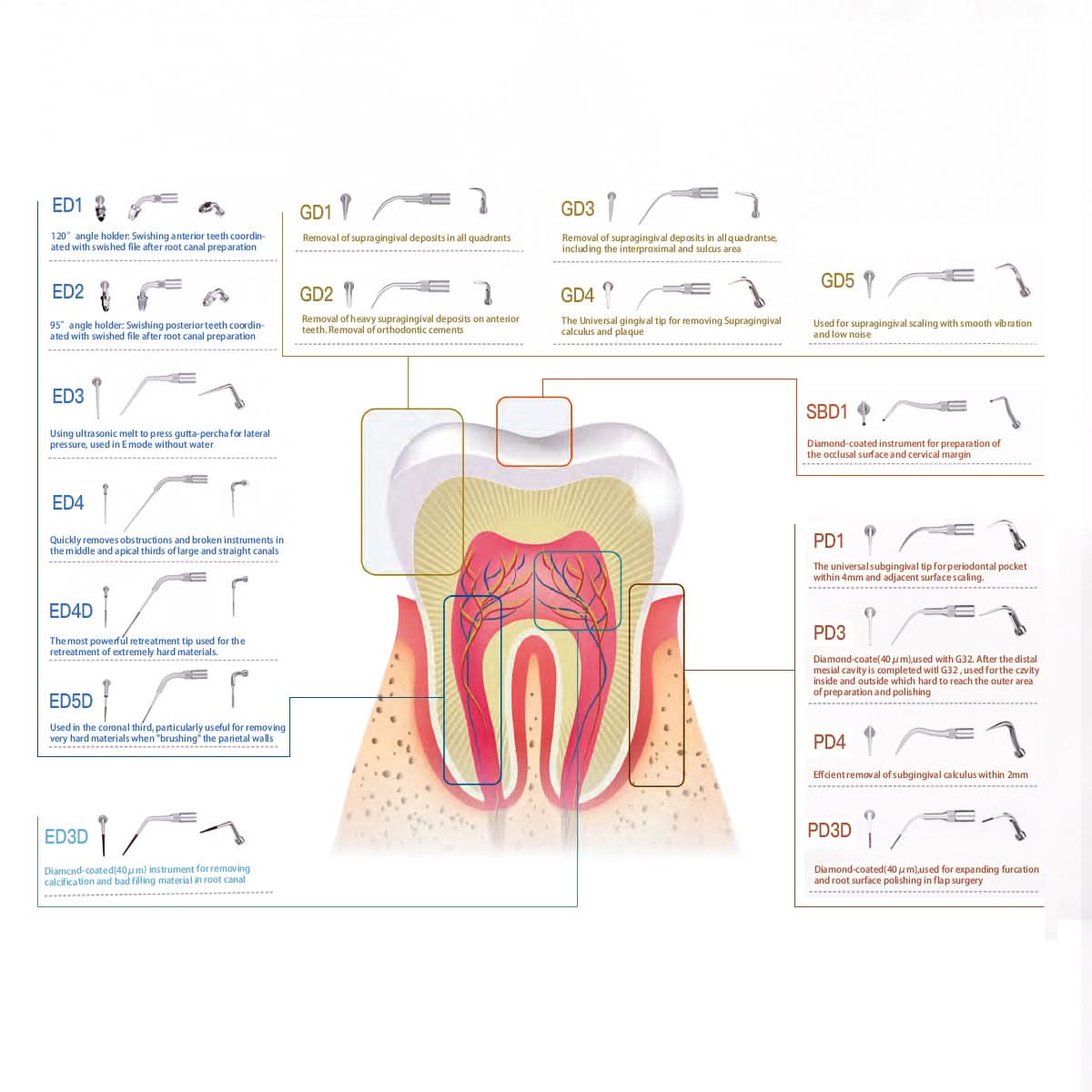 GD4 Ultrasonic Scaler Scaling Tips - pairaydental.com